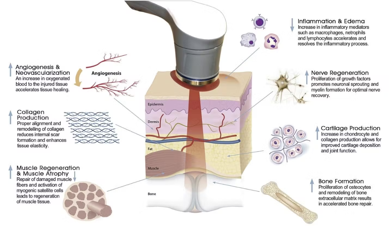 Class iv 2024 laser therapy